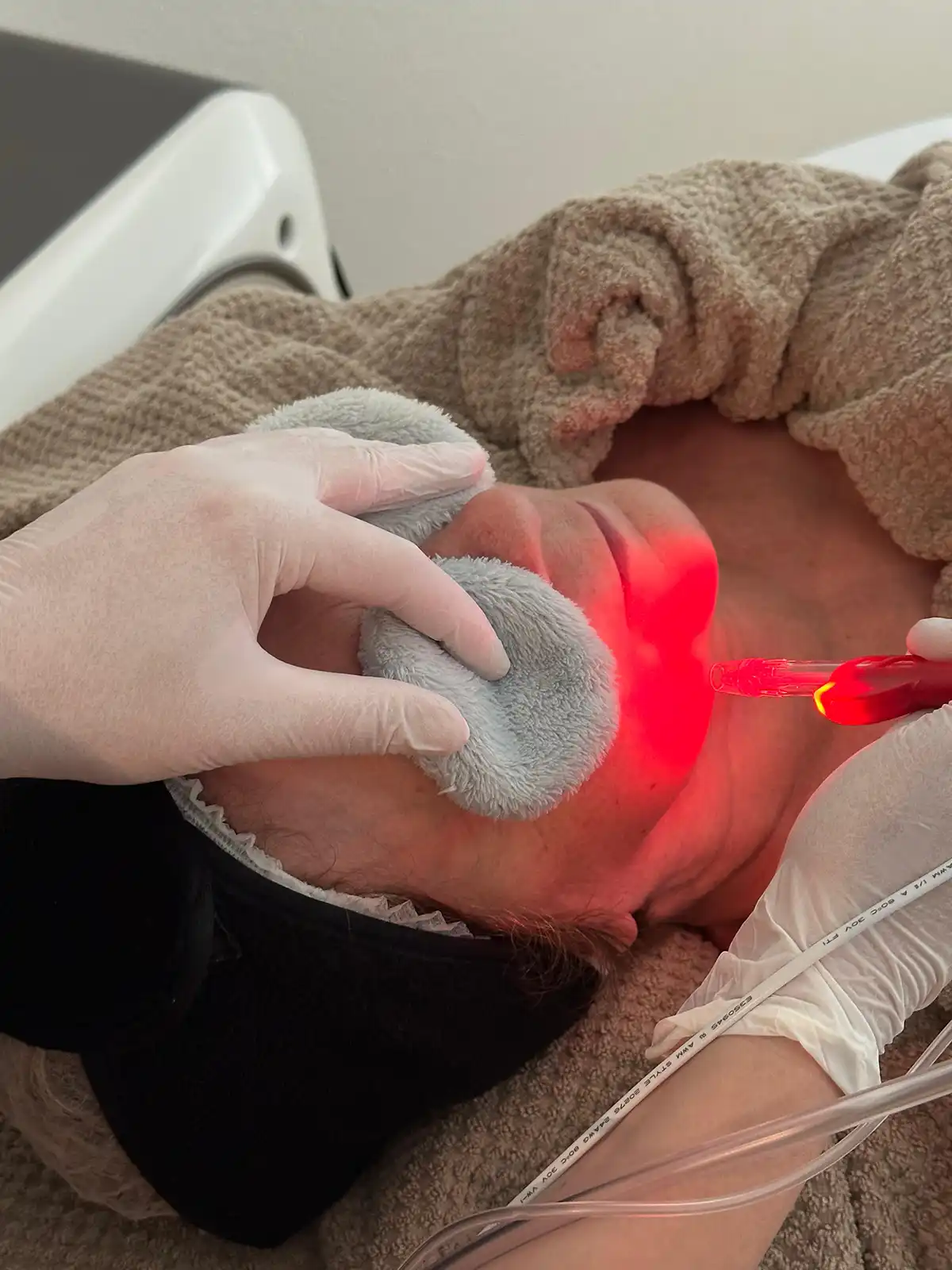 soin-visage-laser Soin laser visage